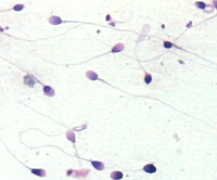 Spermatozoa